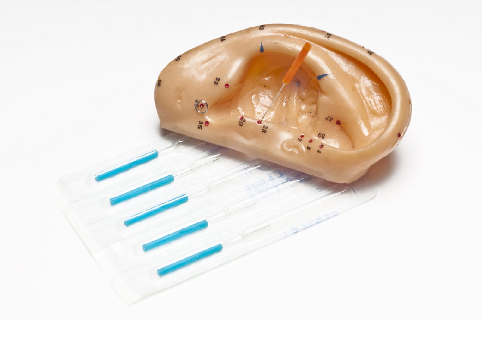 Lær deg øreakupunktur! Vi arrangerer kurs og etterutdanning